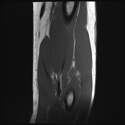 Click on the Serie image to view the images of Wieszt, Gnter